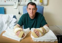 Присадиха две ръце на англичанин