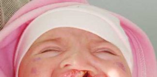 дете с цепната уста