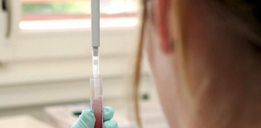 Нов кръвен тест показва колко още ще живеем кръвен тест