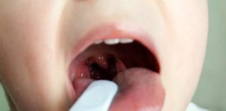 трета сливица