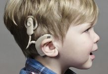 кохлеарен имплант