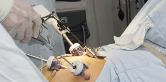 операции за отслабване