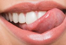 пародонтит