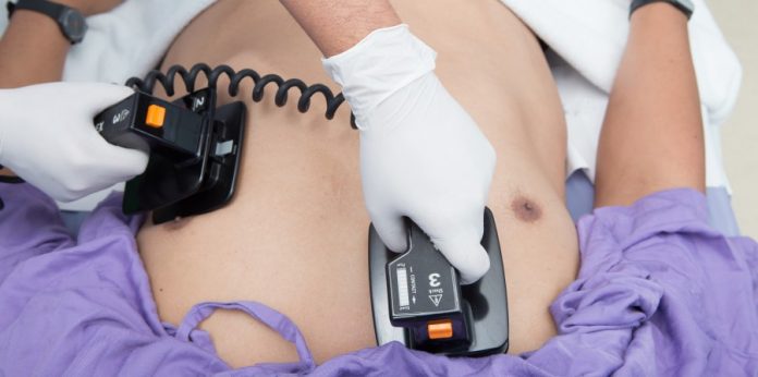 сърдечен арест