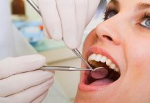 зъбни импланти