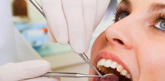 зъбни импланти