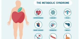 матебалотен синдром