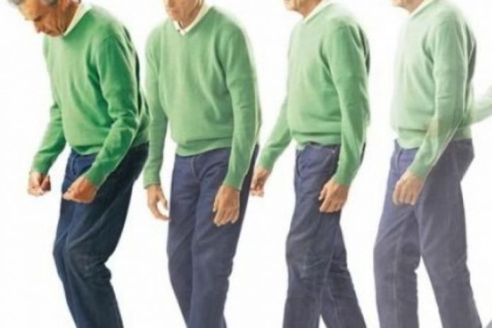 Пиркинсон Паркинсон