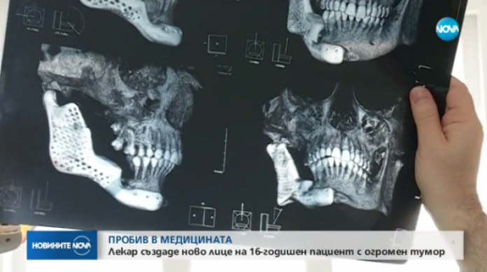 тумор тумор