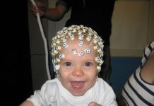 Над 70 000 българи страдат от епилепсия епилепсия