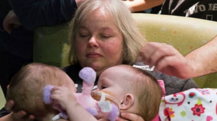 операция операция