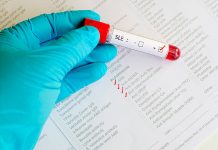 За първи път изследват безплатно за автоимунни болести автоимунни болести