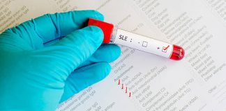 автоимунни болести