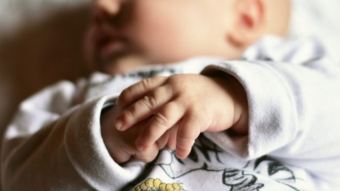 паразитен близнак