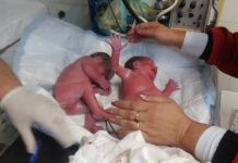 Фелдшерка изроди близначета в линейка близначета