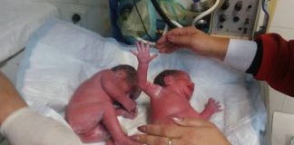 близначета