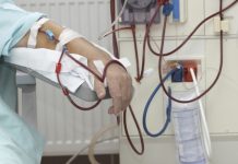 хемодиализа