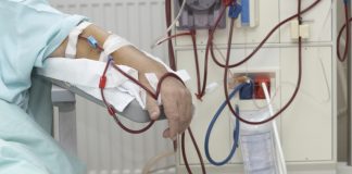 хемодиализа