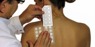 кожни алергии