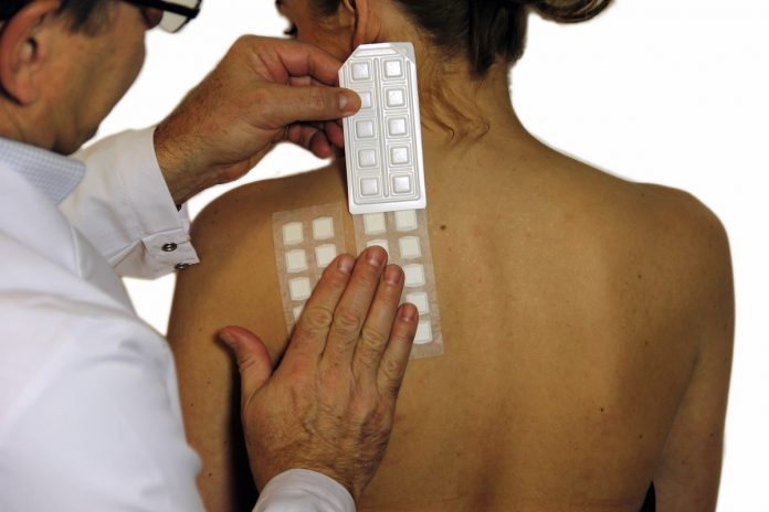 кожни алергии