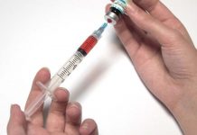 затлъстяване