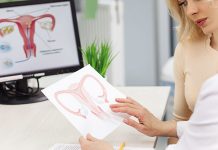 Безплатни прегледи за миома миома