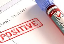 ХИВ-позитивни
