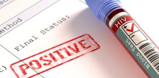 ХИВ-позитивни