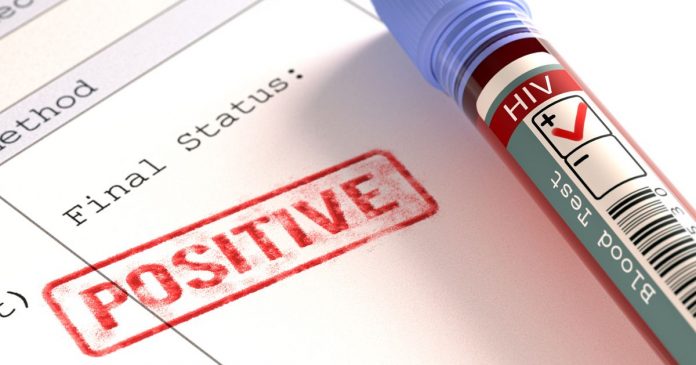 ХИВ-позитивни ХИВ-позитивни