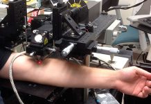 Нов лазер убива туморни клетки в реално време лазер