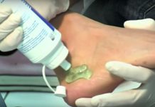 „Майчин дом“ с безплатни изследвания за остеопороза Остеопороза