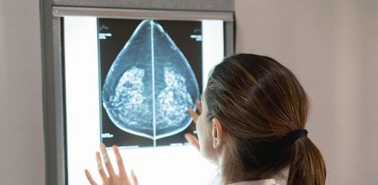 мамография