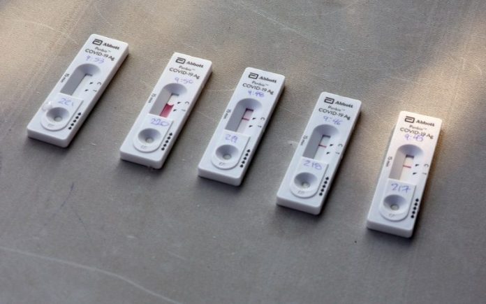 антигенни теста