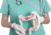 дебелото черво