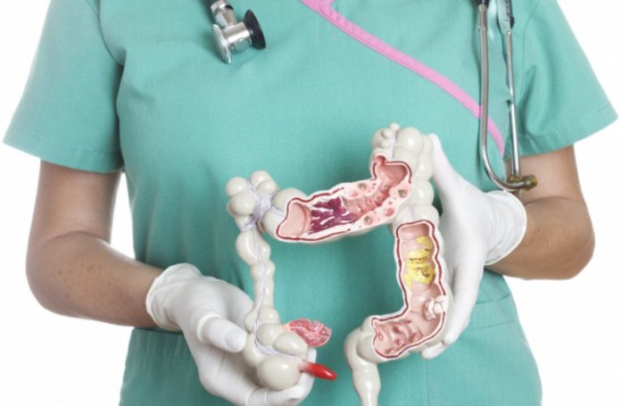 дебелото черво дебелото черво