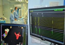 В „Св. Георги“ с 3D навигация вместо с рентген премахват аритмия "Св. Георги"