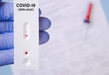 антигенен тест