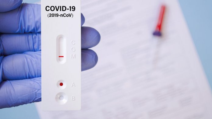 антигенен тест