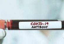 Разрешават издаването на сертификат при наличие на антитела антитела