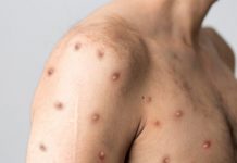 маймунска шарка