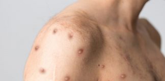 маймунска шарка