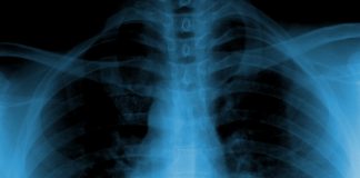 бездимните алтернативи