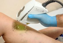 съдов хирург