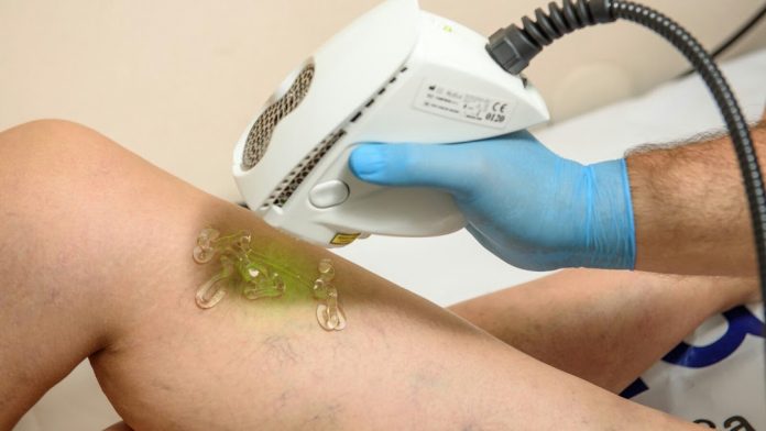 съдов хирург