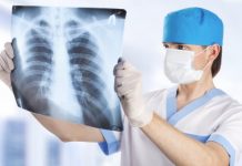 Само 8% от българите с рак на белия дроб живеят над 5 г. рак на белия дроб