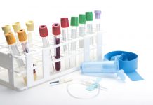 изследвания