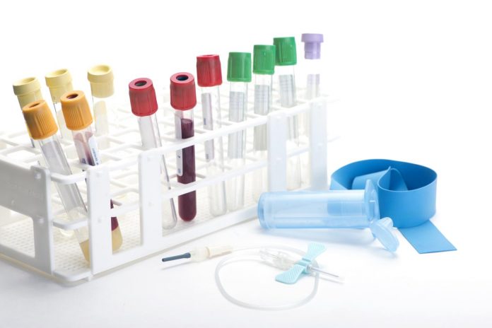 изследвания изследвания