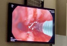 белодробен рак