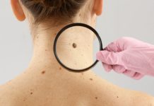 кожни тумори