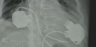 "Св. Екатерина"